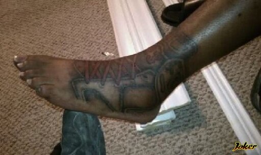 Как выглядит гангрена ноги фото Как выглядит гангрена ноги фото