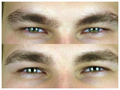 Брови мужские коррекция фото до и после Брови мужские коррекция фото до и после