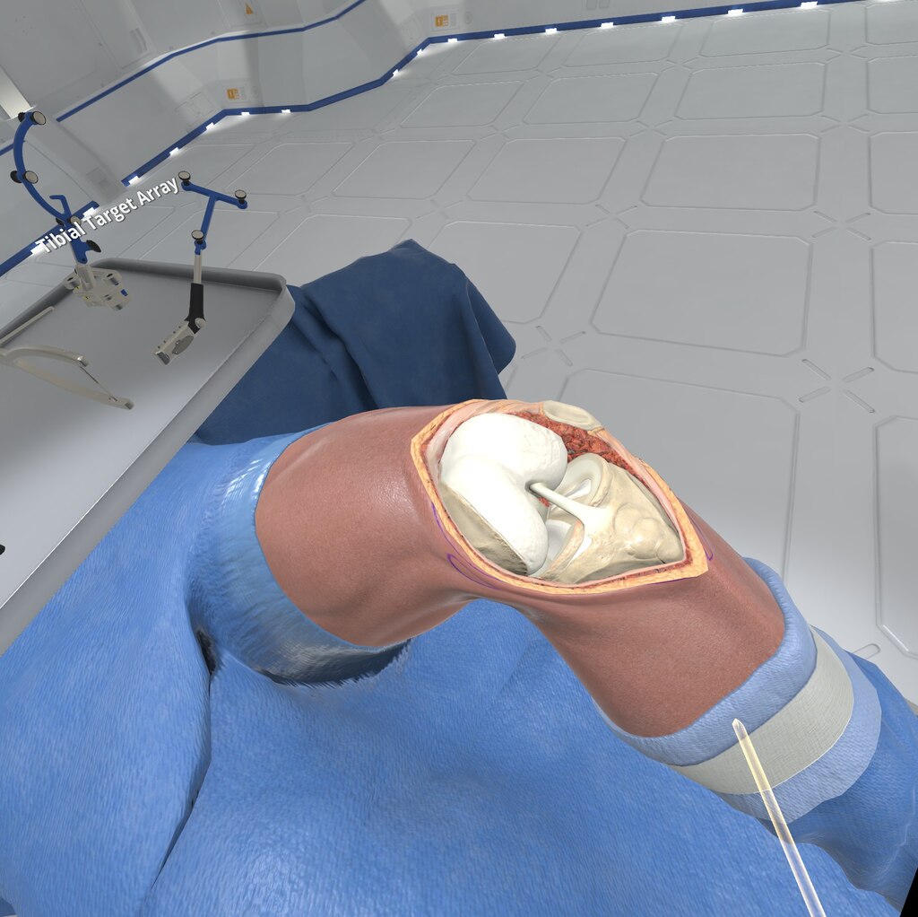 Fazendo uma Cirurgia de Joelho em Realidade Virtual - Wraith VR