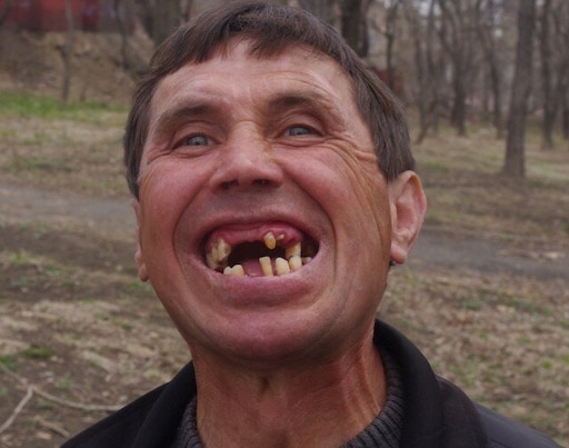 Зуб даю фото Зуб даю фото