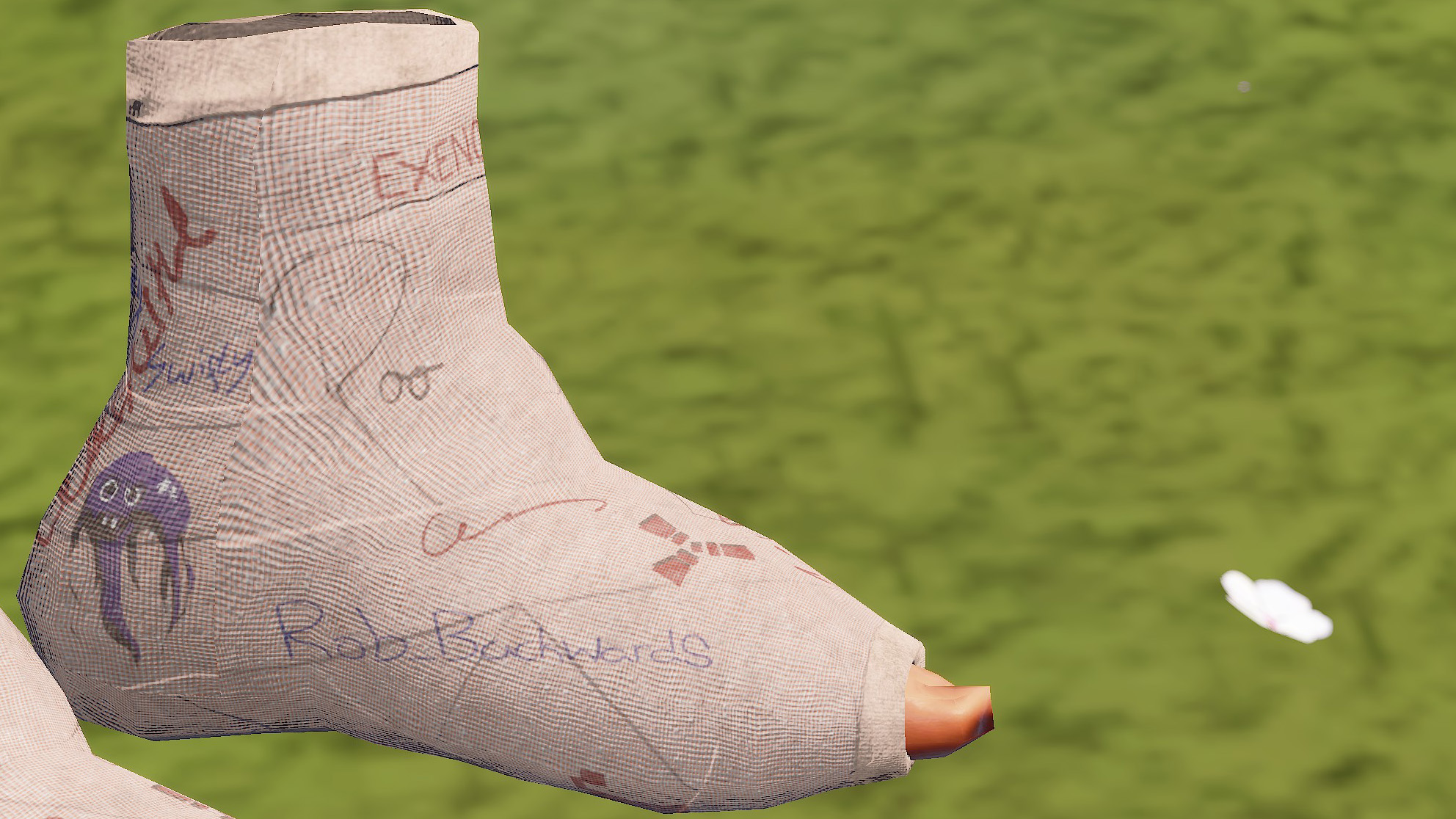 Broken Ankles Cast thumbnail 4
