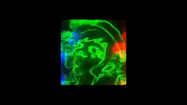 Steam Workshop Hat Kid Gives You Peace And Tranquility By Dancin